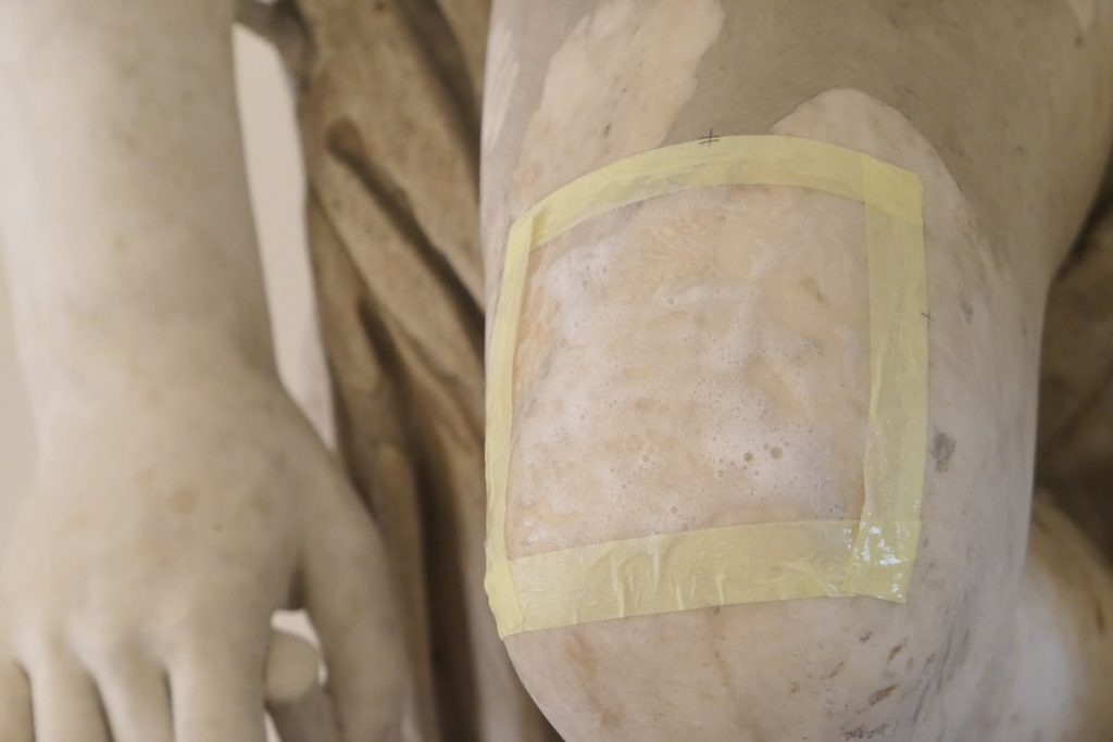 8594__durante trattamento NASIER-min