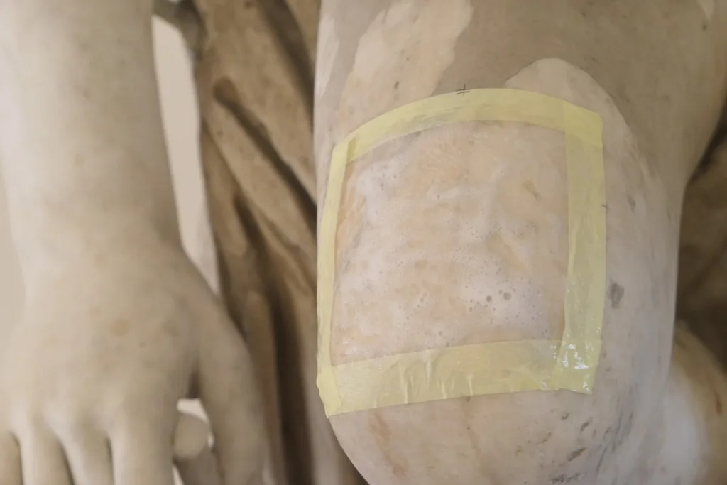 La superficie durante il trattamento NASIER